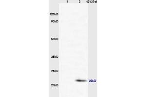 SDS-PAGE (SDS) image for anti-CD69 (CD69) (AA 101-199) antibody (ABIN741150)