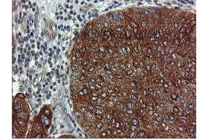Image no. 1 for anti-Farnesyl-Diphosphate Farnesyltransferase 1 (FDFT1) antibody (ABIN1498243) (FDFT1 抗体)