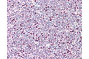 Anti-RAD51B antibody IHC staining of human tonsil. (RAD51 Homolog B 抗体  (AA 143-192))