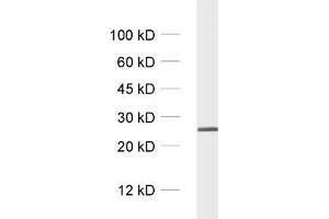 Western Blotting (WB) image for anti-RAB5A, Member RAS Oncogene Family (RAB5A) antibody (ABIN1742214)