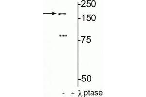Western blot of rat hippocampal lysate showing specific immunolabeling of the ~180 kDa NR2B subunit of the NMDAR phosphorylated at Tyr1472 in the first lane (-). (GRIN2B 抗体  (pTyr1472))