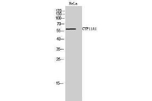 Western Blotting (WB) image for anti-Cytochrome P450, Family 11, Subfamily A, Polypeptide 1 (CYP11A1) (C-Term) antibody (ABIN3184157) (CYP11A1 抗体  (C-Term))