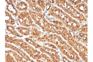Immunohistochemistry (IHC) image for anti-Tumor Necrosis Factor Receptor Superfamily, Member 4 (TNFRSF4) (AA 59-205) antibody (ABIN6940817)