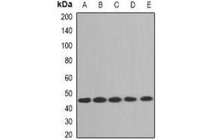 Western blot analysis of Aminoacylase 1 expression in A431 (A), Jurdat (B), mouse brain (C), mouse liver (D), rat kidney (E) whole cell lysates. (Aminoacylase 1 抗体)