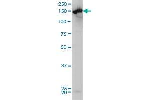 CPS1 monoclonal antibody (M01), clone 8H8 Western Blot analysis of CPS1 expression in HeLa .