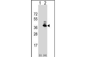 Western blot analysis of AS (arrow) using rabbit polyclonal AS Antibody (N-term) (ABIN390843 and ABIN2841069). (ASPA 抗体  (N-Term))
