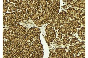 Immunohistochemistry (IHC) image for anti-POU Domain, Class 5, Transcription Factor 2 (POU5F2) (Internal Region) antibody (ABIN6264363)