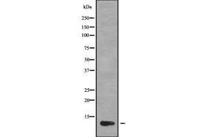 Western blot analysis of CCL1 using MCF7 whole cell lysates (CCL1 抗体  (Internal Region))