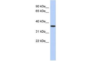 WB Suggested Anti-MVK Antibody Titration: 0. (MVK 抗体  (N-Term))