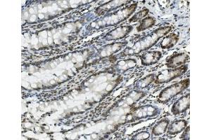 IHC analysis of PRDM5 using anti-PRDM5 antibody (ABIN7600853). (PRDM5 抗体  (AA 24-630))