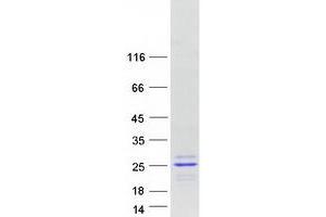 Validation with Western Blot (Claudin 22 (CLDN22) protein (Myc-DYKDDDDK Tag))