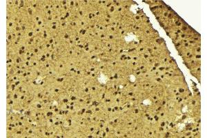 ABIN6275604 at 1/100 staining Mouse brain tissue by IHC-P. (SF3B4 抗体  (N-Term))