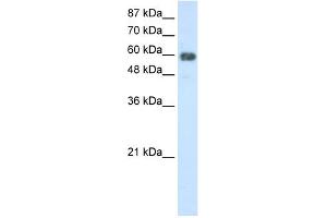 WB Suggested Anti-TROVE2 Antibody Titration:  2. (TROVE2 抗体  (N-Term))