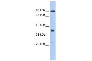 C6ORF154 antibody used at 1 ug/ml to detect target protein. (C6orf154 抗体  (Middle Region))