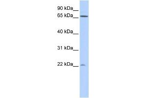 WB Suggested Anti-DIRAS1 Antibody Titration: 0. (DIRAS1 抗体  (N-Term))