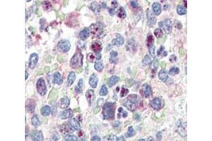 IHC analysis of FFPE human spleen tissue stained with anti-SNAIL antibody (SNAIL 抗体  (AA 9-39))