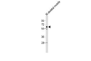Anti-Smarcd3 Antibody (Center) at 1:4000 dilution + mouse skeletal muscle lysates Lysates/proteins at 20 μg per lane. (SMARCD3 抗体  (AA 158-193))