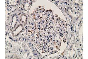 Immunohistochemical staining of paraffin-embedded Human Kidney tissue using anti-OGFOD1 mouse monoclonal antibody. (OGFOD1 抗体)