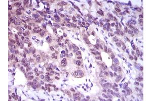 Image no. 1 for anti-ATP Citrate Lyase (ACLY) antibody (ABIN1491378) (ACLY 抗体)