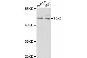 Western blot analysis of extracts of various cell lines, using SGK2 antibody (ABIN5998798) at 1/1000 dilution. (SGK2 抗体)
