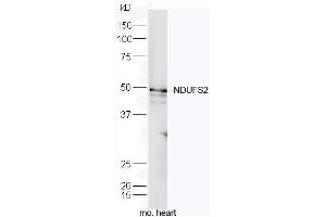 Mouse heart lysates probed with Rabbit Anti-NDUFS2 Polyclonal Antibody, Unconjugated (ABIN1714214) at 1:300 overnight at 4˚C.