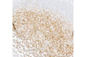 Immunohistochemistry (IHC) image for anti-Complement Component (3d/Epstein Barr Virus) Receptor 2 (CR2) (C-Term) antibody (ABIN7795815)