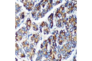 Immunohistochemistry (IHC) image for anti-Pleckstrin Homology Domain Containing, Family B (Evectins) Member 2 (PLEKHB2) (AA 1-222) antibody (ABIN7269415)