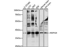 Western blot analysis of extracts of various cell lines, using RSPH14 antibody (ABIN6290181) at 1:1000 dilution. (RTDR1 抗体)