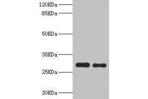 Western Blotting (WB) image for anti-Proteasome (Prosome, Macropain) Activator Subunit 1 (PA28 Alpha) (PSME1) (AA 1-249) antibody (ABIN7164913)