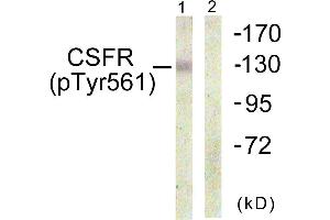 Immunohistochemistry analysis of paraffin-embedded human brain using CSFR (Phospho-Tyr561) antibody. (CSF1R 抗体  (pTyr561))