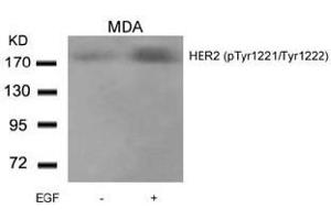 Image no. 2 for anti-Receptor tyrosine-protein kinase erbB-2 (ErbB2/Her2) (pTyr1221), (pTyr1222) antibody (ABIN196751) (ErbB2/Her2 抗体  (pTyr1221, pTyr1222))