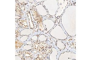 IHC analysis of SNRNP40 using anti-SNRNP40 antibody (ABIN7601719). (SNRNP40 抗体  (AA 43-357))