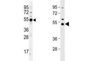 Western blot analysis of Dnmt2 antibody and different lots of mouse cerebellum lysate. (Dnmt2 抗体  (AA 346-375))