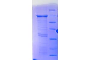 SDS-PAGE (SDS) image for T-Box 15 (TBX15) (AA 1-494), (Isoform 2) protein (His-SUMO Tag) (ABIN5711589)