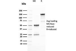 SDS-PAGE Analysis Purified HER-2 Mouse Monoclonal Antibody (ERBB2/3080). (ErbB2/Her2 抗体  (AA 311-462))