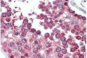 Human Brain, Cortex (formalin-fixed, paraffin-embedded) stained with SOD2 antibody ABIN396955 at 1:50 followed by biotinylated anti-mouse IgG secondary antibody ABIN481714, alkaline phosphatase-streptavidin and chromogen. (SOD2 抗体)