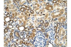 C3orf31 antibody was used for immunohistochemistry at a concentration of 4-8 ug/ml. (TAM41 抗体  (N-Term))