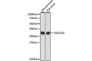 Western blot analysis of extracts of various cell lines, using TAS2R10 antibody.