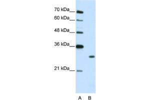 Western Blotting (WB) image for anti-Muscleblind-like Protein 1 (MBNL1) antibody (ABIN2462372) (MBNL1 抗体)