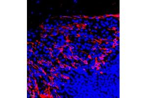 Immunofluorescent analysis of paraffin embedded human tonsil using CK6 (ABIN7074423) at dilution of 1: 2000 (Keratin 6 抗体)