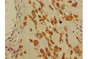 Immunohistochemistry of paraffin-embedded human placenta tissue using ABIN7150506 at dilution of 1:100 (DNAJB11 抗体  (AA 53-238))