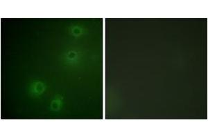 Immunofluorescence analysis of COS7 cells, using Integrin beta1 (Phospho-Thr789) Antibody. (ITGB1 抗体  (pThr789))