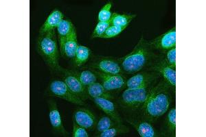 IF analysis of WDR36 using anti-WDR36 antibody (ABIN7602409) and anti-Tubulin Alpha antibody (ABIN7600339).