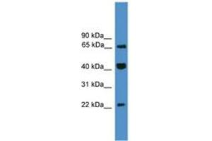 Image no. 1 for anti-Transcription Elongation Factor A (SII)-Like 6 (TCEAL6) (C-Term) antibody (ABIN6745441) (TCEAL6 抗体  (C-Term))
