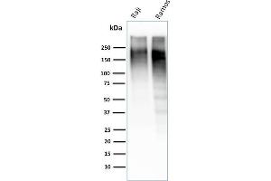 Western Blot Analysis of Raji and Ramos cell lysate using Ki67-Monospecific Mouse Monoclonal Antibody (MKI67/2462). (Ki-67 抗体  (AA 2293-2478))