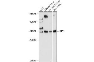 Western blot analysis of extracts of various cell lines, using PPT1 antibody (ABIN7269164) at 1:1000 dilution. (PPT1 抗体  (AA 28-306))