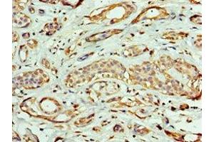 Immunohistochemistry of paraffin-embedded human breast cancer using ABIN7161953 at dilution of 1:100 (EXOG 抗体  (AA 144-368))