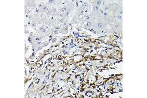 Immunohistochemistry of paraffin-embedded human liver using CD90/Thy1 Rabbit mAb (ABIN6129735, ABIN6148554, ABIN6148555 and ABIN7101405) at dilution of 1:100 (40x lens). (CD90 抗体)