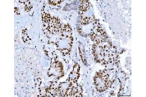 IHC analysis of SP1 using anti-SP1 antibody (ABIN7601559). (SP1 抗体  (AA 384-603))