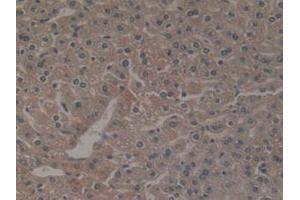 IHC-P analysis of Mouse Liver Tissue, with DAB staining. (NCF4 抗体  (AA 111-339))